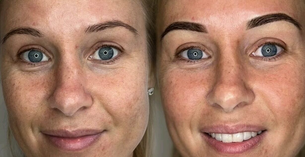 Permanent makeup brow transformation by Jenna’s PMU in Welling, Bexley.